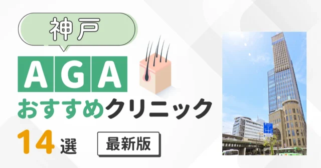 神戸のAGA治療がおすすめのクリニック14選 薄毛治療はどこがいい？